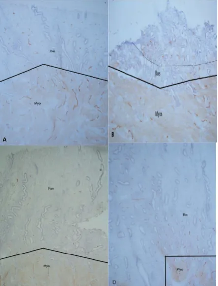 Table phatic vessels in the deep basalis compared to scattered, 1). There were numerous small and large lym-small and fragmented lymphatic vessels on the surface of 