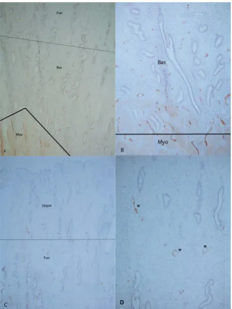 Figure 2. Mid-proliferative phase, Day 14, Case 1 ((A) and endometrium ((C) and (D)). (A), (B) and (D): ×100, C: ×50