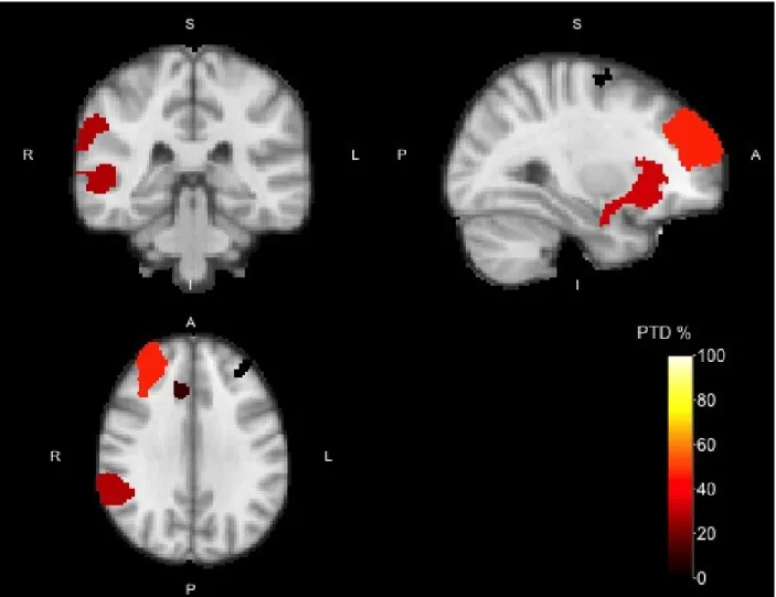 Figure 1: Activation map of the No-go > Go contrast with cluster-forming threshold Z > 3.2 for the Go/No-go data
