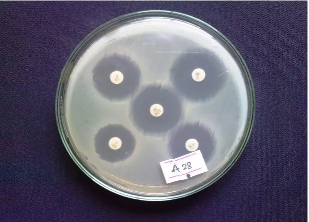 Figure 10: Antimicrobial susceptibility of S. Typhi 
