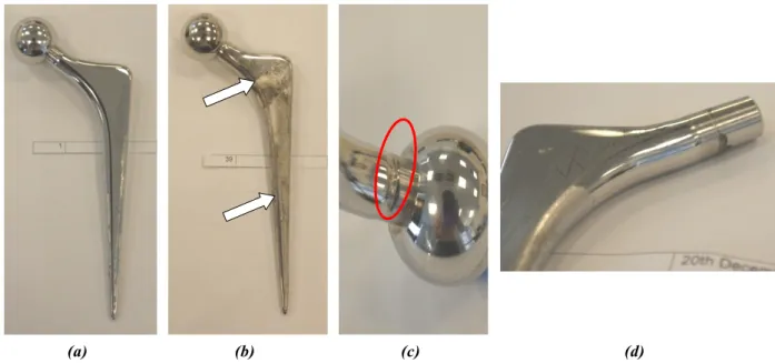 Figure 4- typical macroscopic observation of (a) retrieved femoral stem with low and (b) high observation grading