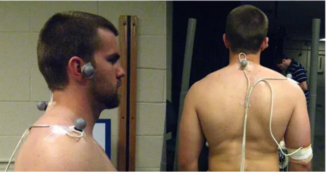 Figure 1 - Receiver and reflective marker placement for humerus, scapula, tragus and spinous process of C7 