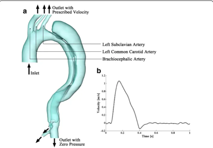 Figure 2 Boundary settings of the model. (a) describes the boundary conditions at each inlet and outlets;(b) displays the cross-sectional velocity profile of the inlet at the ascending aorta