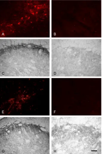 Fig. 1. pERK and pp38 antibodies: preabsorption controls. Photomicrographs illustrating (A–D) pERK and (E–H) pp38 immunohistochemistry insubnucleus caudalis