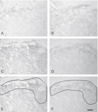 Fig. 2. Fos immunohistochemistry in subnucleus caudalis from animals with stimulated and/or inﬂamed tooth pulps