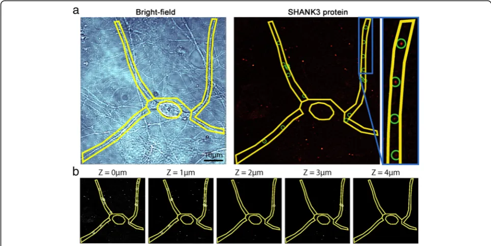 Fig. 1 SHANK3 mRNA and protein puncta selection in hiPSC-derived cortical neurons. a Left panel: bright-field images used to manually outline cellbody and neuronal processes