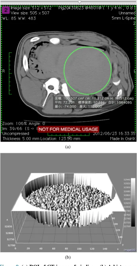 Figure 9. (a) ROI of CT image of pig liver; (b) A histogram before as a stiffness mapping of ROI by expression (3b)