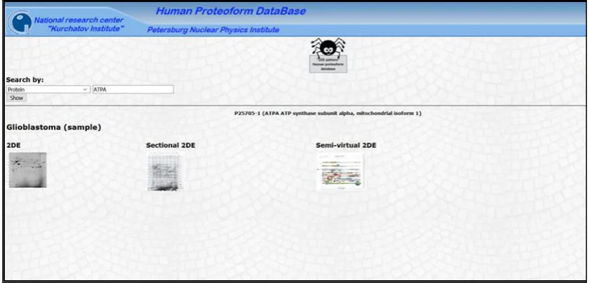 Figure 2. A protein page of the human proteoform database “2DE pattern”. Main information about ATP synthase subunit alpha (ATPA) is shown