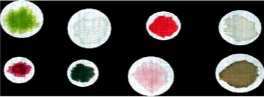 Fig.5. Extracted ROI of samples 