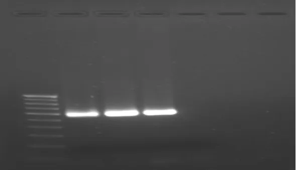 Table 5: PCR conditions 