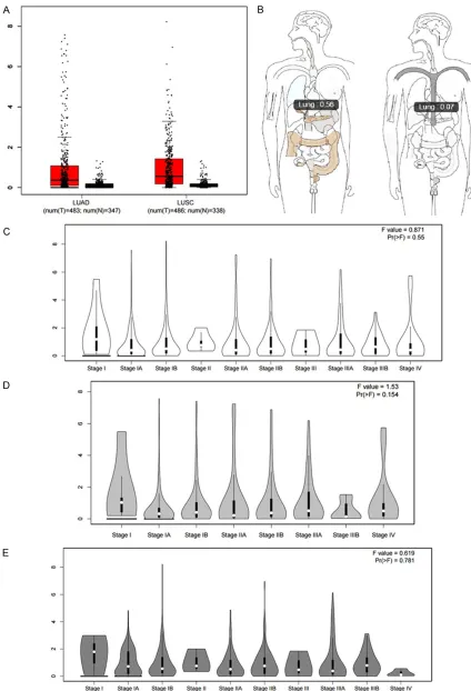 Figure 3. Expression level of UCA1 mRNA provided by GEPIA. The expression of UCA1 was provided by GEPIA