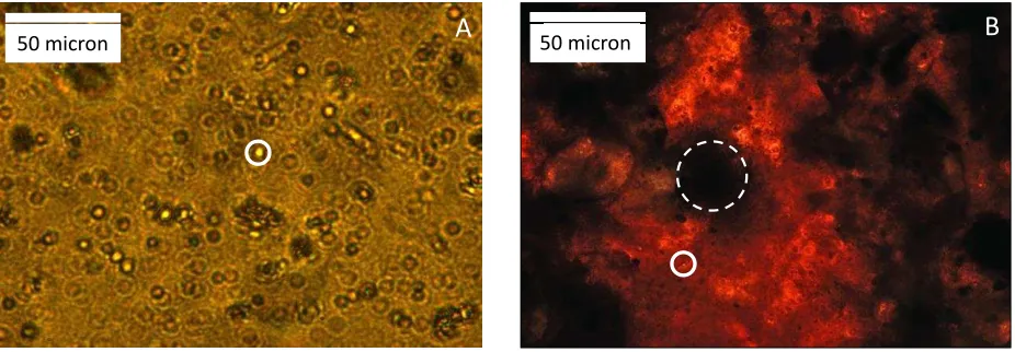 Figure 1 Optical microscope image of a sample removed from the oil layer (A) and the rag layer 