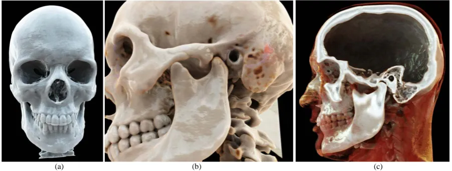 Figure 1. Cinematic Rendering of a non-contrast-enhanced CT head scan with rendering of the bony surface (a) (b) and depiction of the interior of the skull in the area of the midline by means of sagittal clip plane (c)