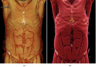 Figure 2. Volume Rendering (a) and Cinematic Rendering (b) of a whole-body CT scan with depiction of the thoracic and abdominal musculature; the musculature is depicted considerably more realistically by Cinematic Rendering than by Volume Rendering