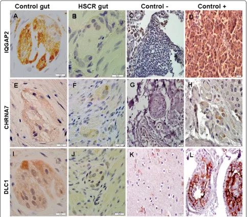 Figure 4 Expression analysis by RT-PCR of IQGAP2 (A), CHRNA7 (B) and DLC1 (C) in human gut tissues