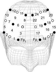 Figure 1 Channel positions for near-infrared spectroscopy. Changes in oxyhemoglobin concentration were measured at 24 sites in the bilateral frontal areas of the brain