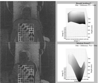 Figure 9. Distributions of cross correlation coefficients on the surface of the participant (100 s measurement)