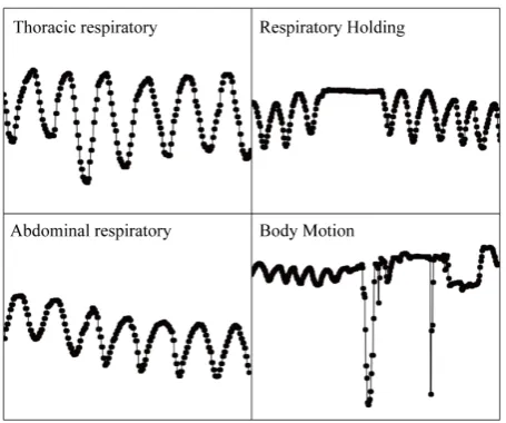 Figure 5. The comparison of measured respiratory patterns for the abdominal respiration (left) and the breath holding (right)