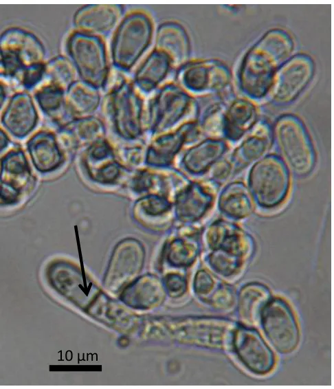 Figure 1. Optical microscope image of S. pombe. The transverse septum formed during the 
