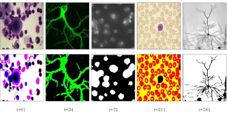 Figure 3. Entropic segmentation for a brain cell image with a spatial noise around. 