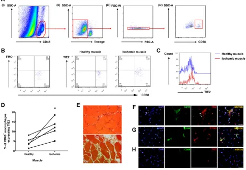 Figure 2. Quantification of TIE2R macrophages in human muscle specimens.
