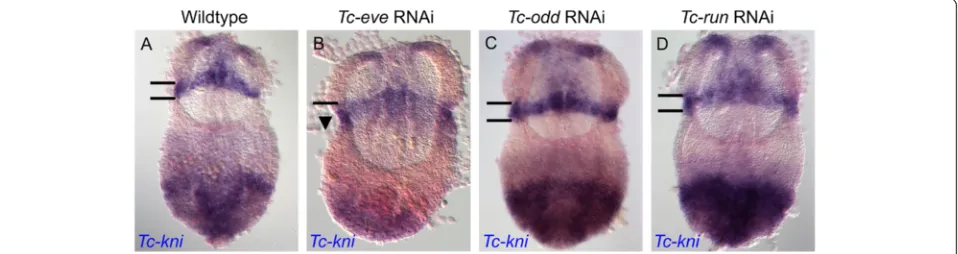 Figure 9 Tc-knisegment setting the posterior boundary of the(bounded by black horizontal lines in panelsRNAi (panel is regulated by Tc-eve