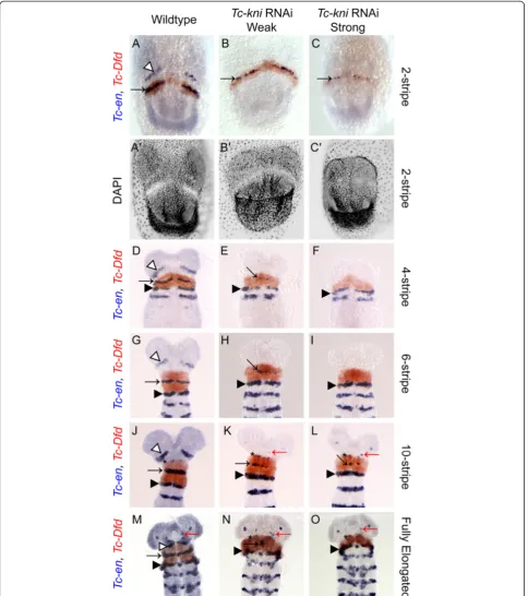 Figure 2 Expression of Tc-en and Tc-Dfd in wildtype and Tc-kni RNAi embryos. The antennal Tc-en stripe (marked by white arrowhead inwildtype panels A, D, G, J, M) is missing in all Tc-kni RNAi embryos