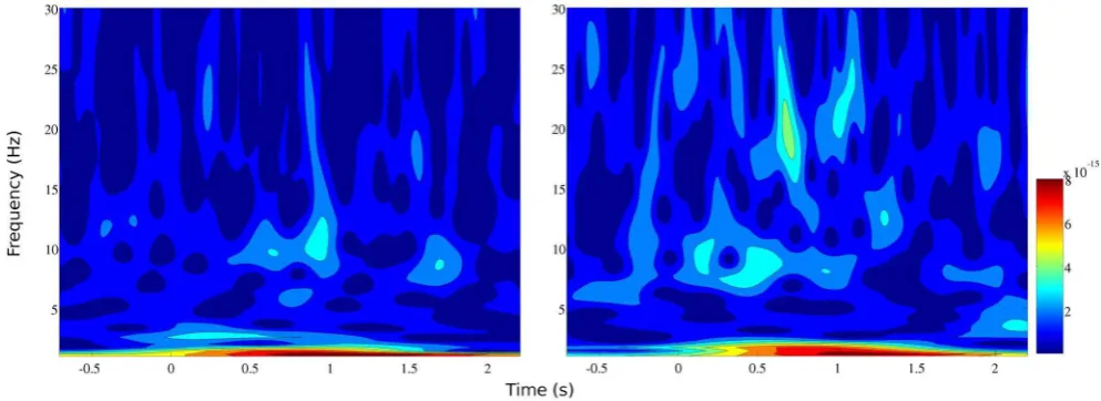 Figure 4. Event-related fields from the sensor-space analysis are shown for a representative subject