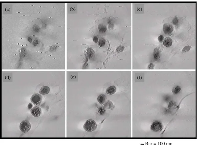 Figure 7. (a)-(f) UHVEM, tomogram sequential images of isolated B16 melanosomes fraction by the preparative method of 2.3