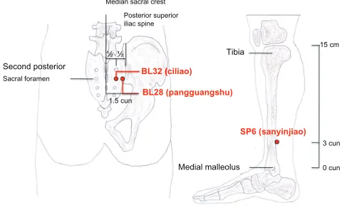Figure 1 Locations of acupuncture points based on the WHO standards for the Western Pacific region.16  Redrawn by Yu and Chou