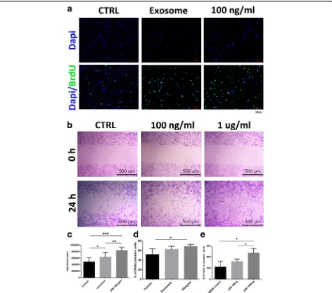 Fig. 5 Effect of α2M on cell proliferation, migration, and viability. a Immunofluorescence imaging of bromodeoxyuridine (BrdU) incorporation intoproliferating cells