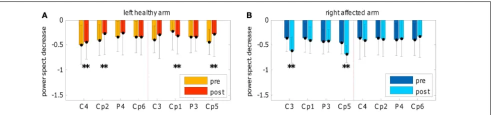 FIGURE 4 | Brain oscillations before and after training.two conditions across training ( R2 maps of therest and movement); “pre” refers topre-evaluation, “tr” refers to training, “post” refers to post-evaluation,“wk” refers to week (1 or 2), “R” refers to 