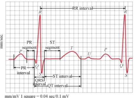 Figure 1. Significant features of one beat ECG signal. 