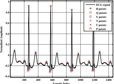 Figure 2. It illustrates the ECG signal with P, Q, R, S, T and U points indicated. 
