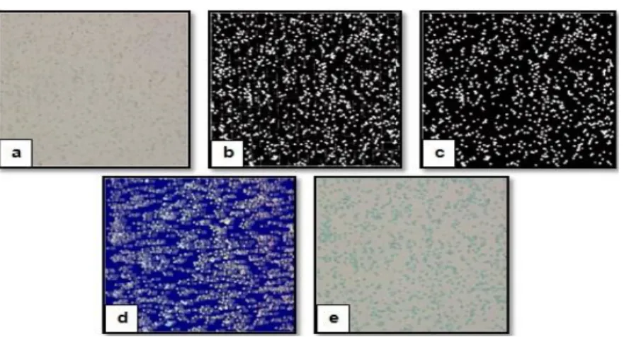 Figure 1.  Results of Erythrocyte Processing: a. Cropping Result, b. Dynamic Contrast and Filling Results, c