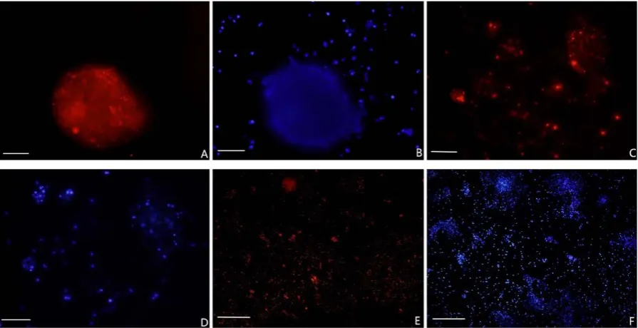 Figure 2. The photos of neural stem cell identification. (A) Immunofluorescent staining indicated that Nestin was stained in the cytoplasm with a clear nuclear boundary