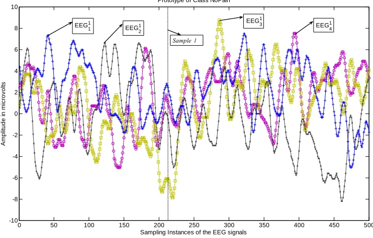 Figure 4.1 (a)  Prototype EEG signals for the class No Pain for one of the channels 