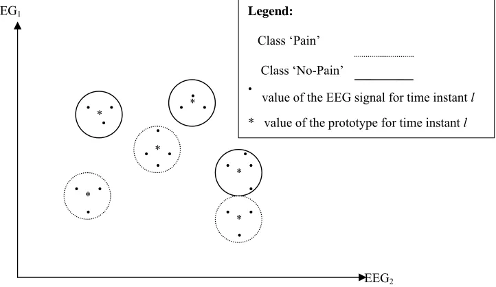 Figure 4.1 (b)  Prototype EEG signals for the class Pain for the same channel 