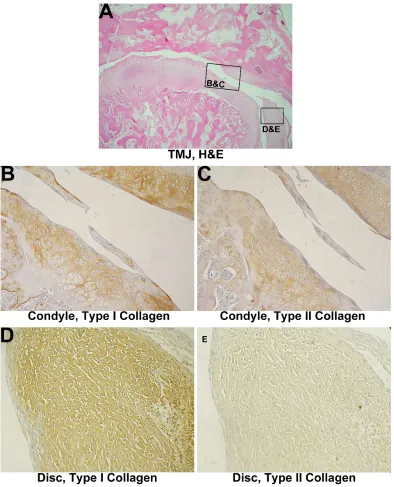 Figure 2. Histological analysis of a 1-month discectomied TMJ without implantation. 