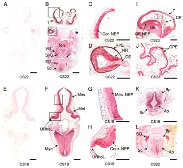 Figure 1. AHI1J = 250AHI1developing telencephalon, especially the neuroepithelium (C) and neural retina (D)