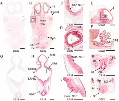 Figure 3. CEP290 is expressed in the developing cerebellum, spinal cord and eye. (A, G) Negative control hybridisation with CEP290 senseRNA probe and (B–F) hybridisation with CEP290 antisense RNA probe to transverse sections at CS22