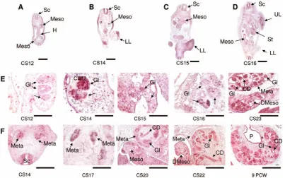 Figure 4. CEP290CS22 and 9 PCW = 125and (B) CS14; (C) CS15; (D) CS16. is expressed in the developing kidney