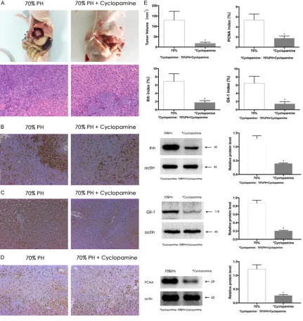 Figure 3. Suppressing Hh signaling inhibited the growth of implanted tumors after PH. Cyclopamine inhibited the growth of hepatic implanted tumor, and the expression of Ihh, Gli-1 and PCNA in para-tumor liver tissue in mice after 70% partial hepatectomy