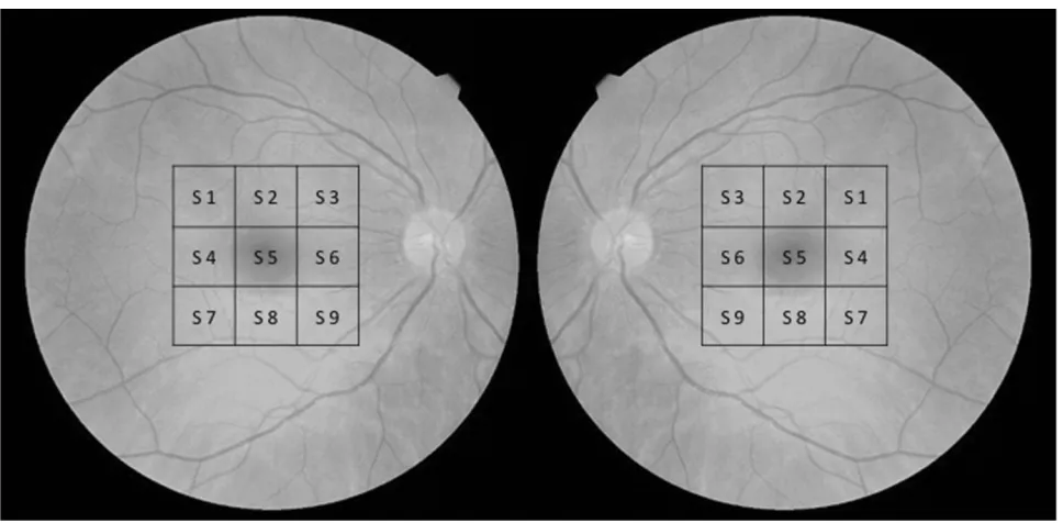 Figure 2 Customized 13-points-grid for microperimetry for right and left eyes. Diagram showing the location of each studied point in the microperimetric exam
