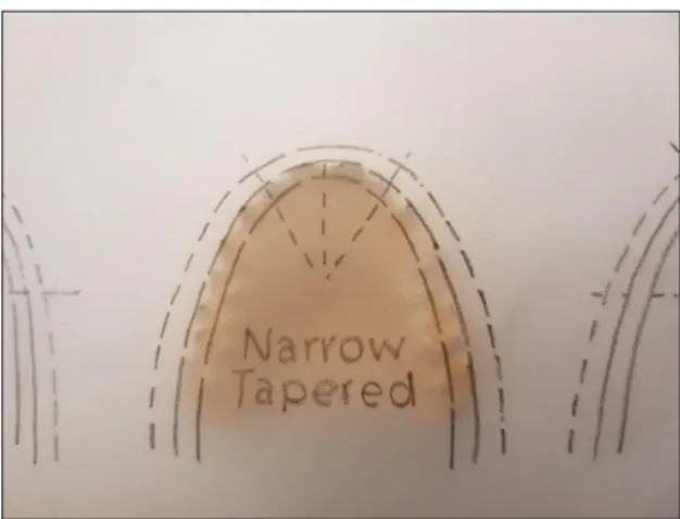 Fig. 3.  La forme de l’arcade dans la charte pentamorphique adaptée au modèle maxillaire 