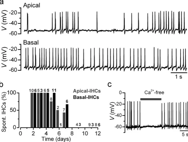 Figure 2. Inward sodium current in IHCs. Inward currents (inward current (black traces)