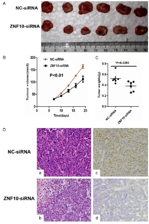 Figure 4. ZNF10 enhances the tumorigenicity of breast IDC in vivo. (A-C) ZNF10 knockdown significantly suppressed breast cancer growth (A), tumor weight (B), and the tumor volume (C) of MCF7 cells implanted subcutaneously in BALB/c-nu mice compared with th