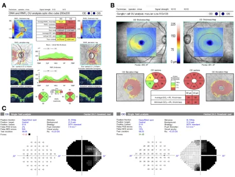 Figure 3 Structural and functional data of an example case of compressive optic neuropathy