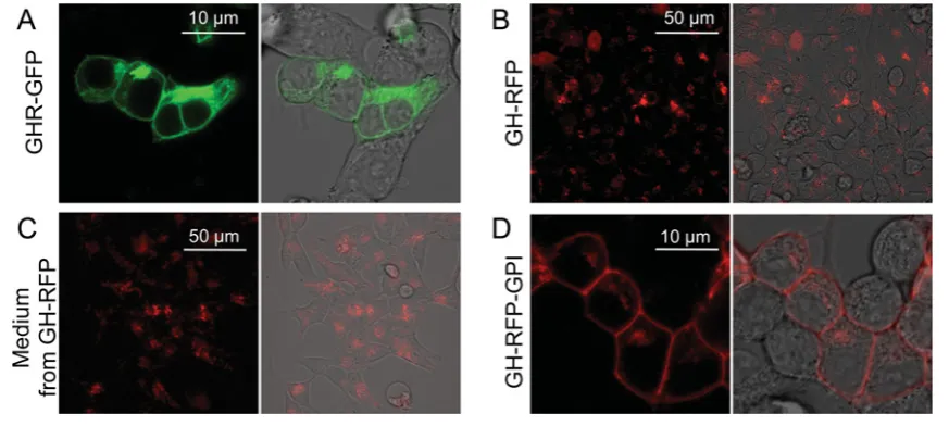 Figure 4Intracellular localization of ﬂuorescent fusion proteins(A, B) HEK-293 cells imaged after transfection with either the green ﬂuorescent GHR fusion construct, GHR–GFP (