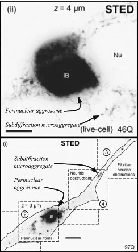 Figure 1 Subdiffraction Microscopy Reveals PMAs. Adapted       from Delayed emergence of subdiffraction sized mutant huntingtin fibrils following inclusion body formation by SJ Sahl         et al